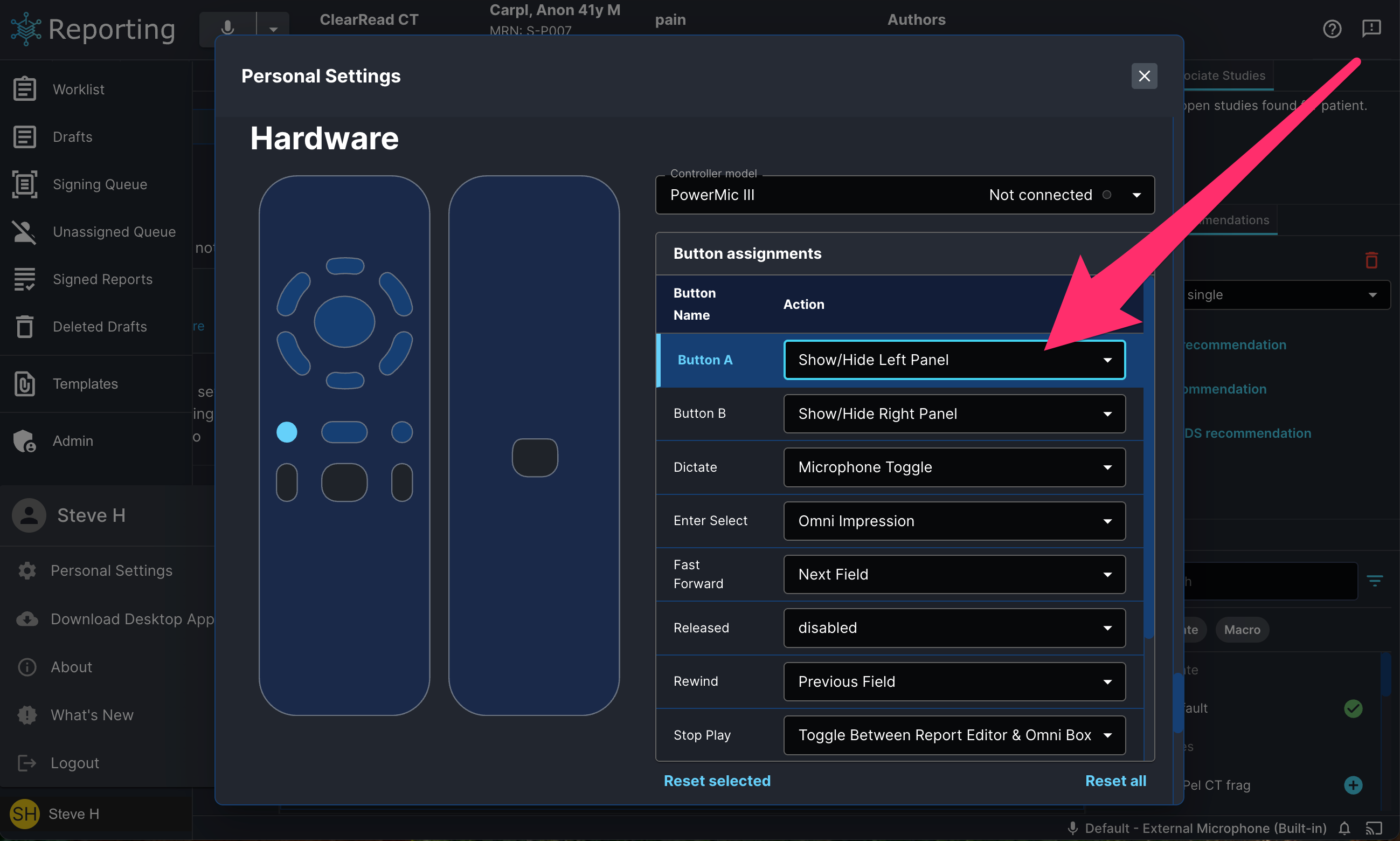 hardware_button_assignment_setting.png