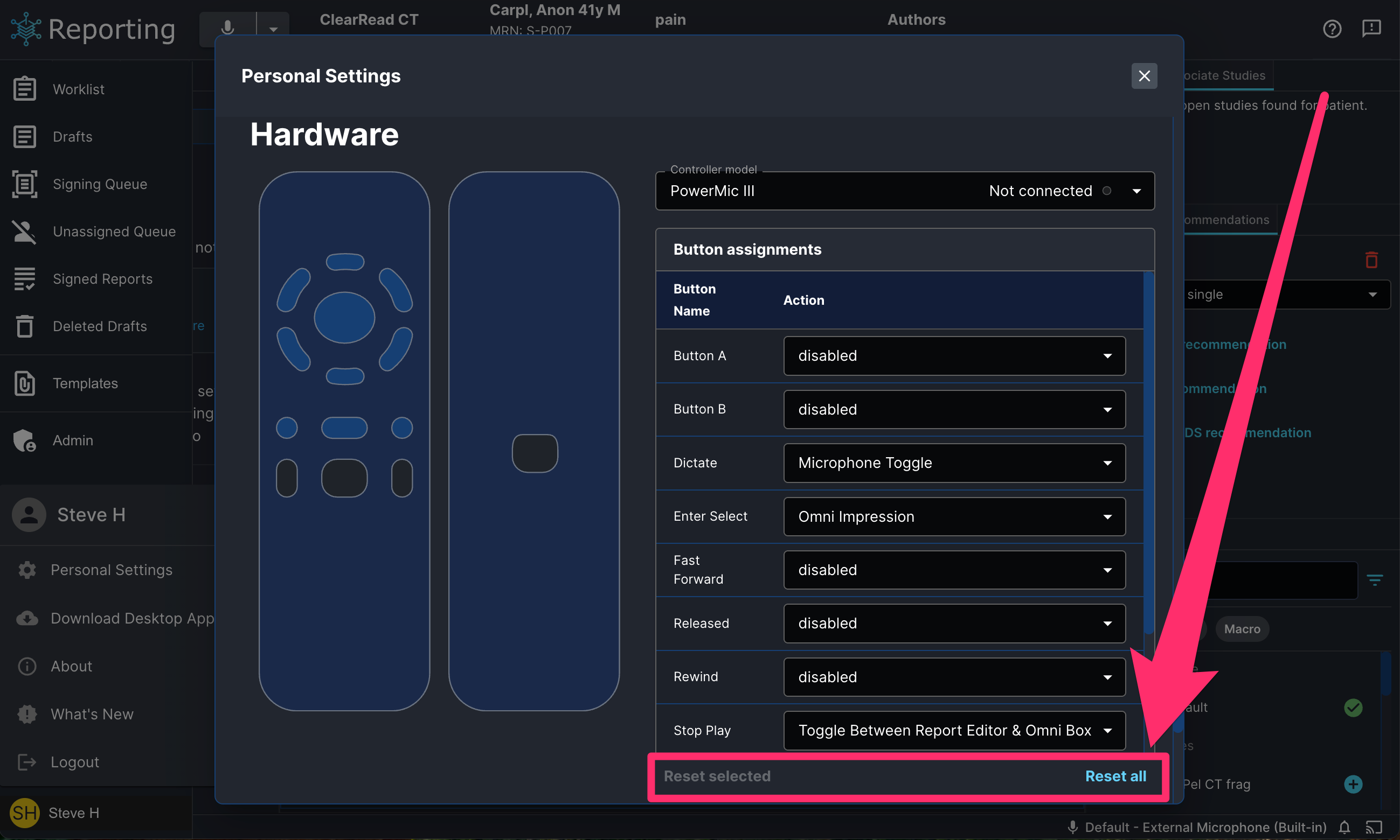 hardware_button_assignment_reset_setting.png