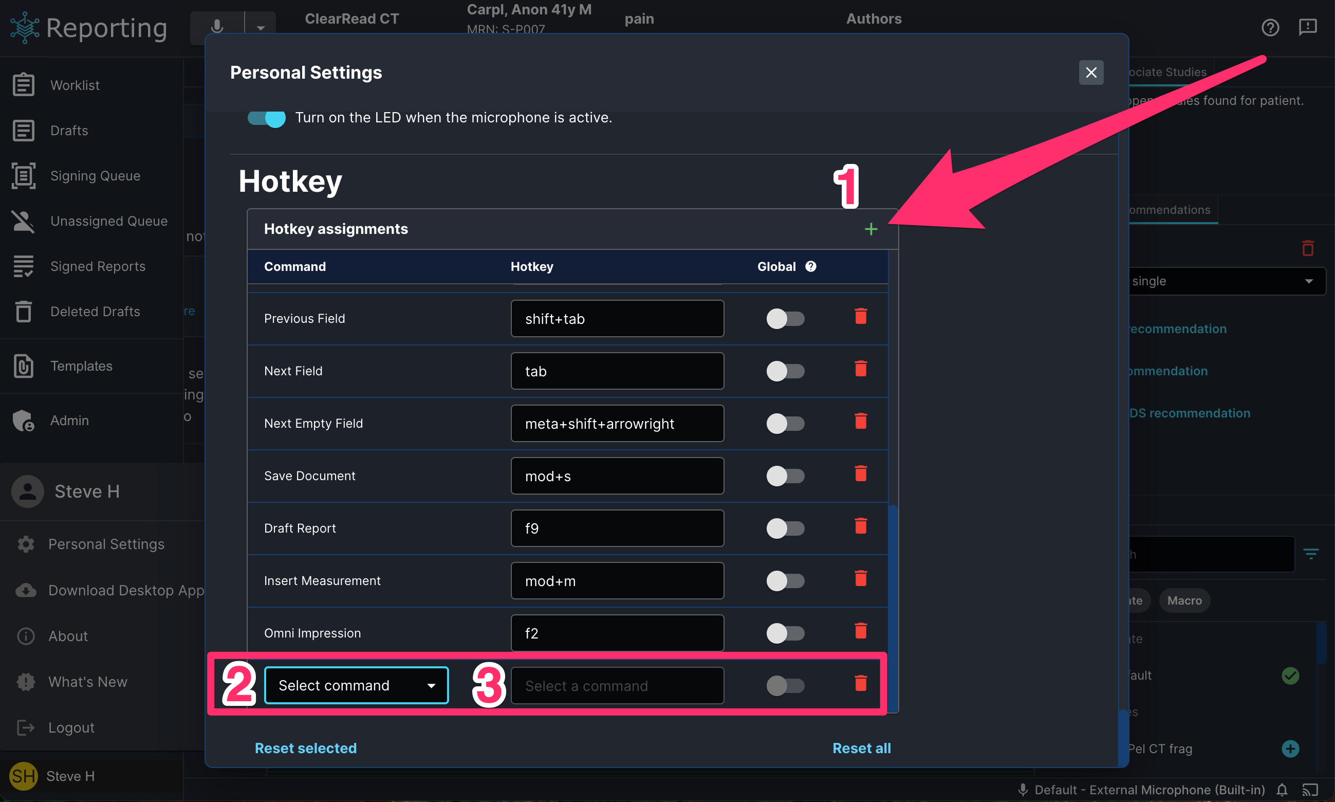 new_hotkey_assignment_setting.png