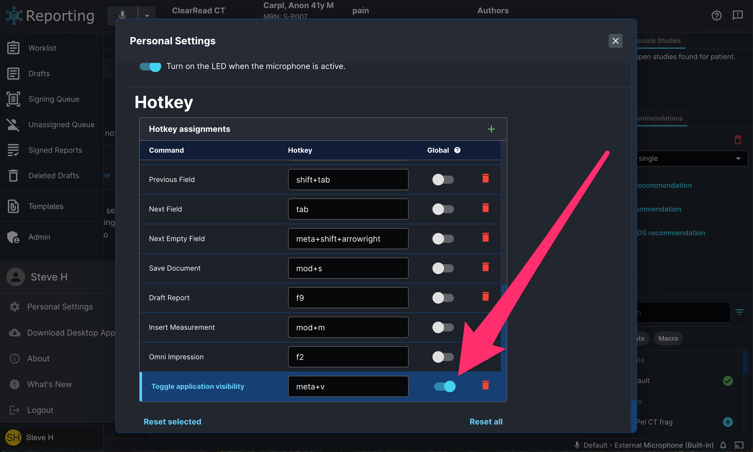 global_toggle_hotkey_setting.png