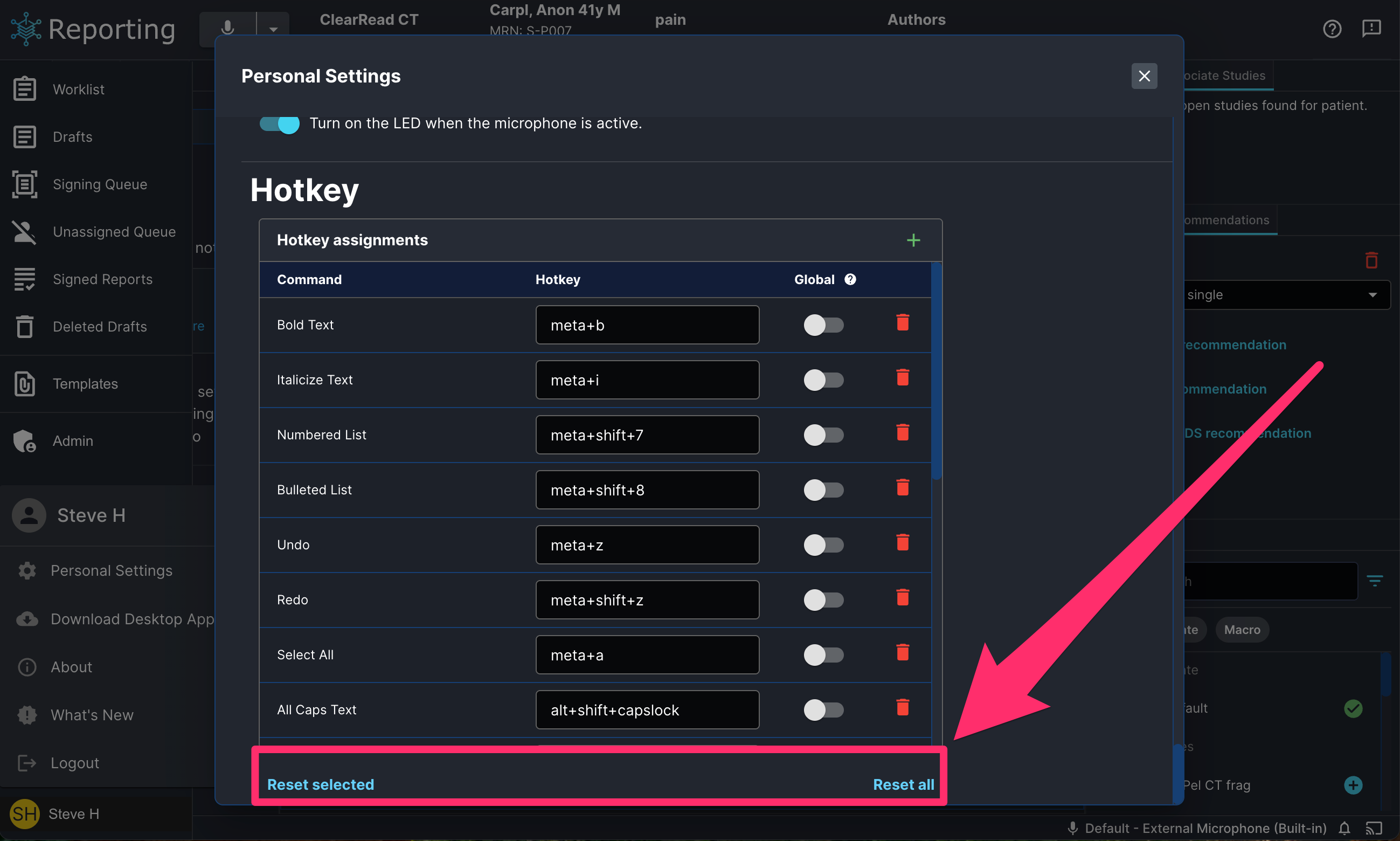 reset_hotkey_assignments_setting.png