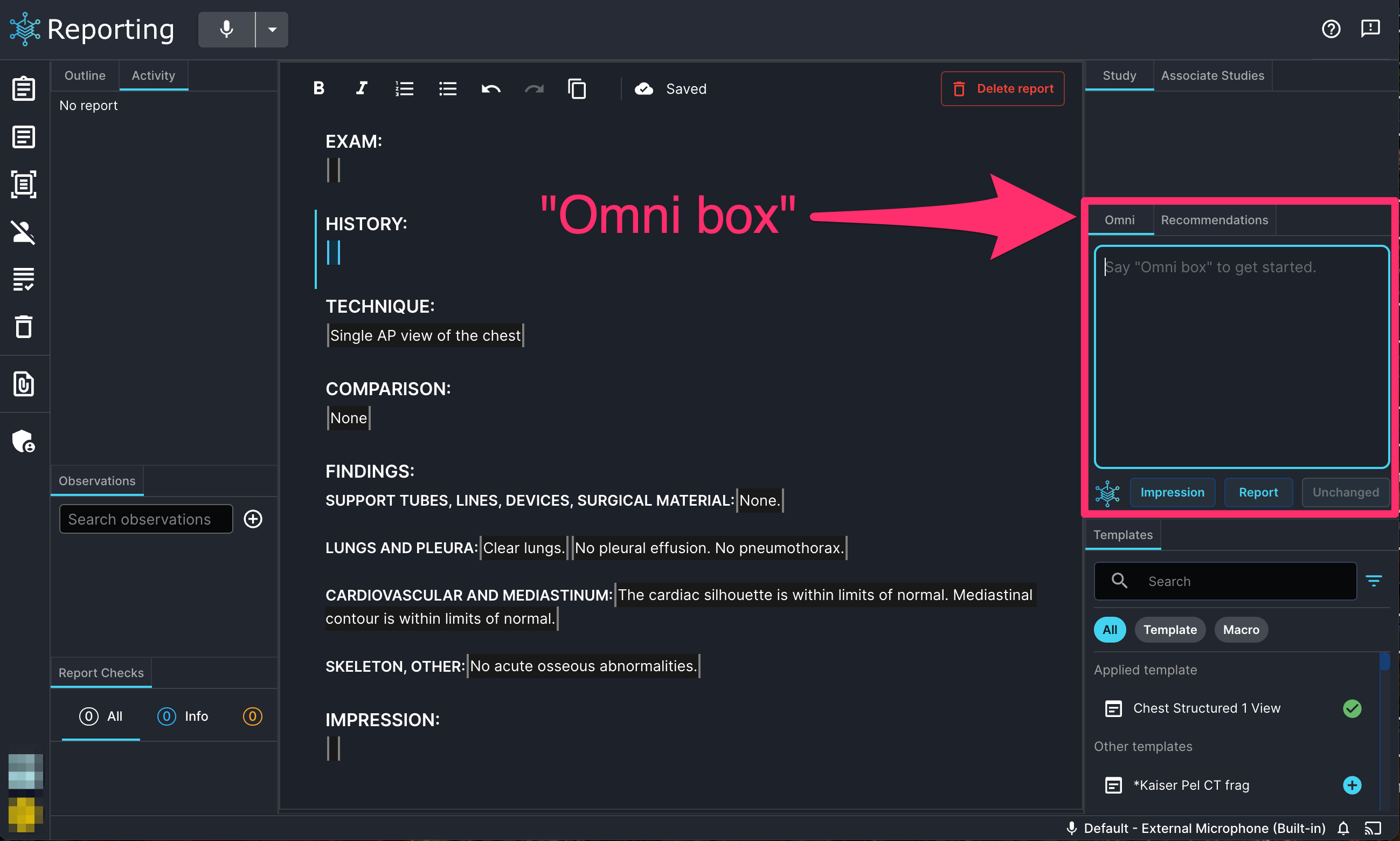 omni_box_voice_command.png