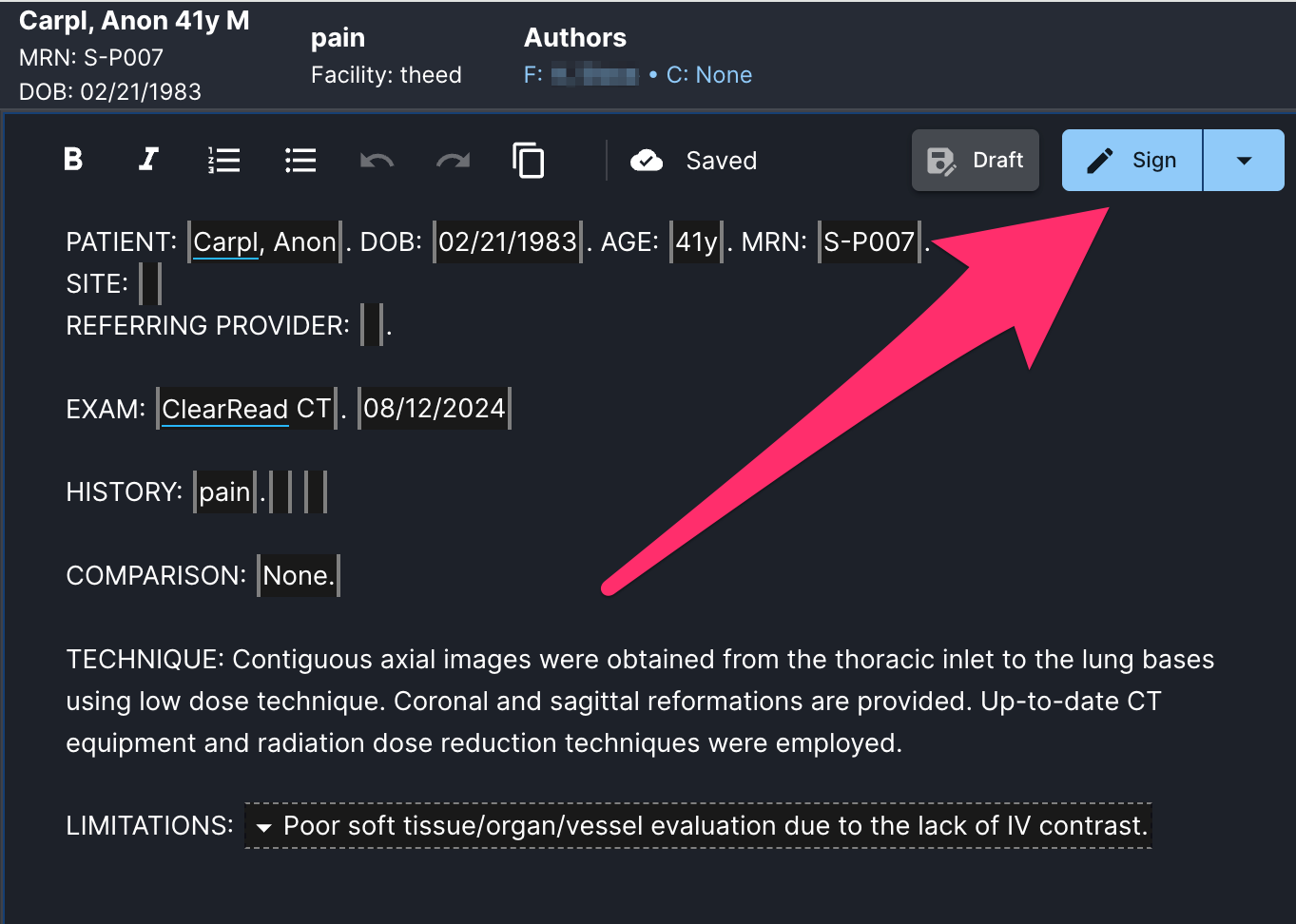 primary_report_action_editor.png