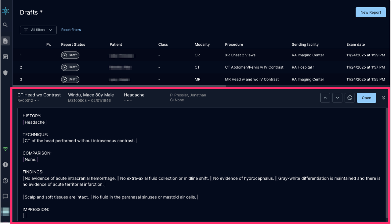 Report Preview displayed in the report workbench
