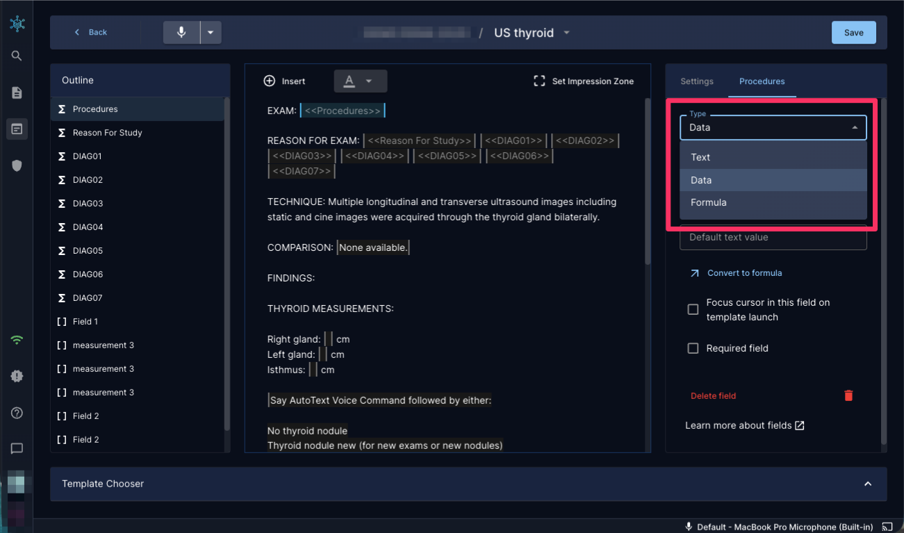 Template editor open and displaying a template with the field Type dialog open and circled in red